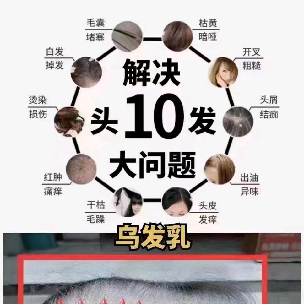 九牛工作室头皮抗衰