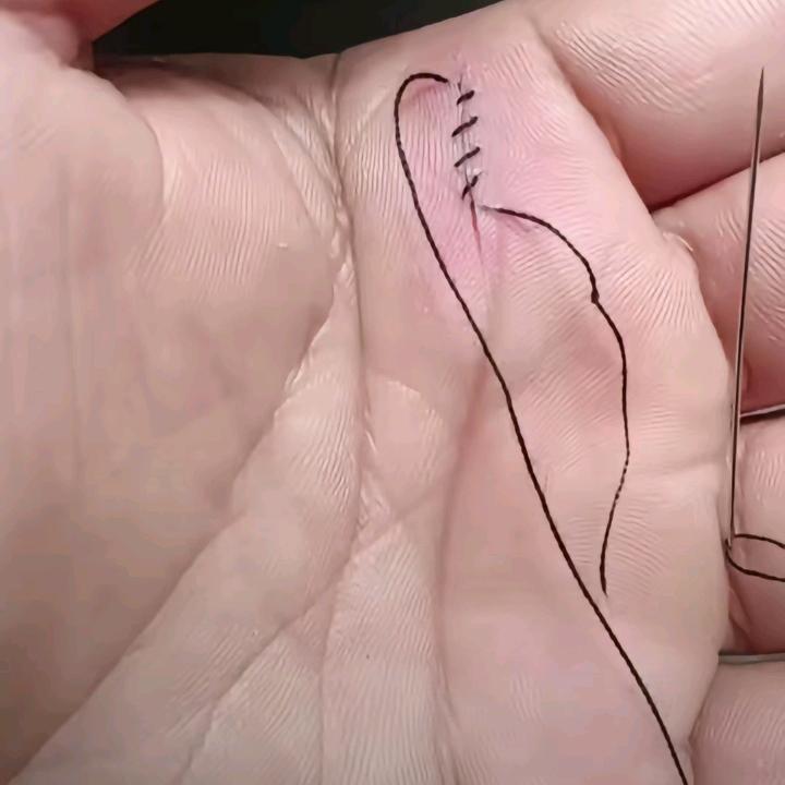 瓦拉挌斯