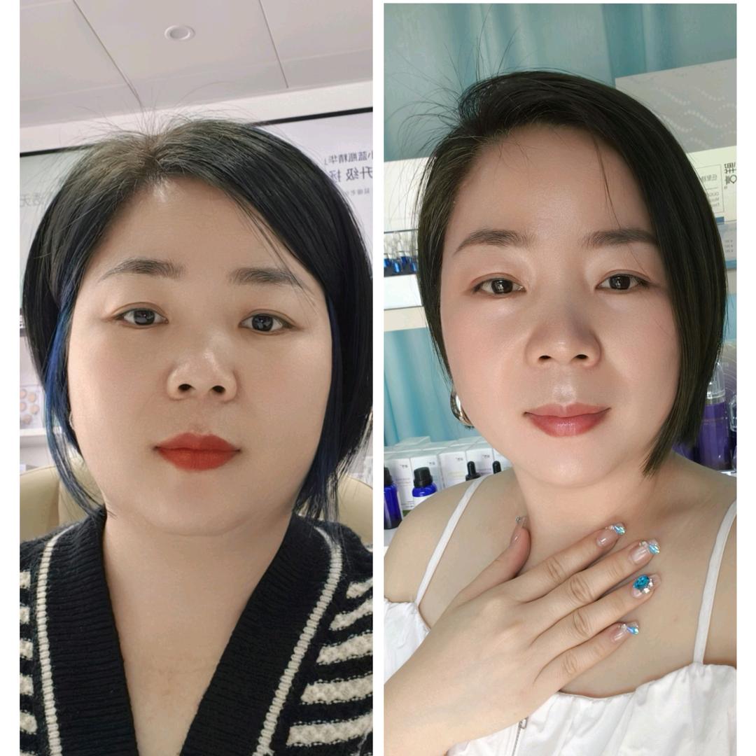 减肥形体管理+解决问题肌肤