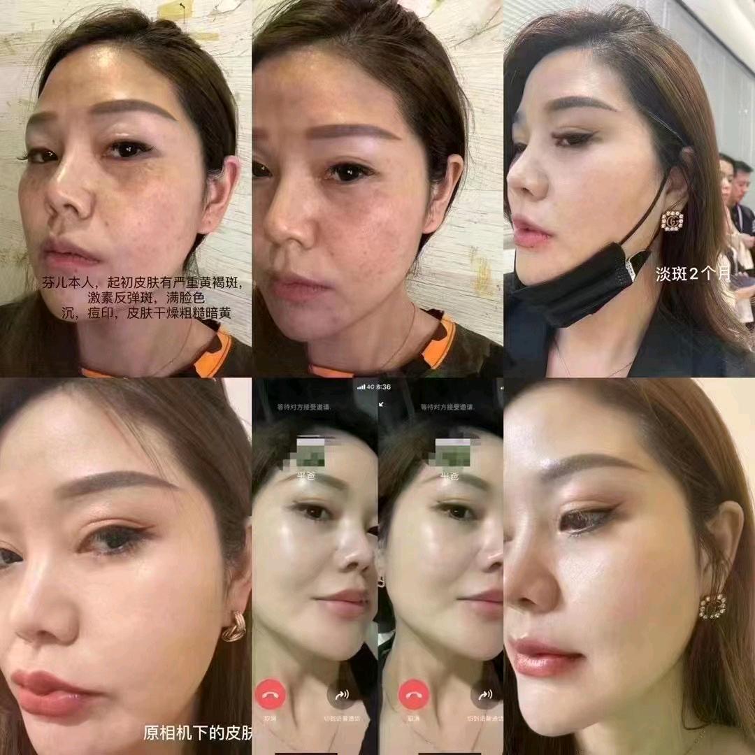 娜娜皮肤管理
