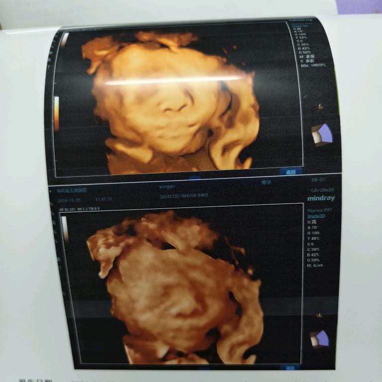 可爱宝贝