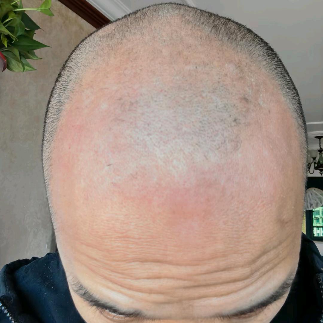 绿洲养发（细软提升）