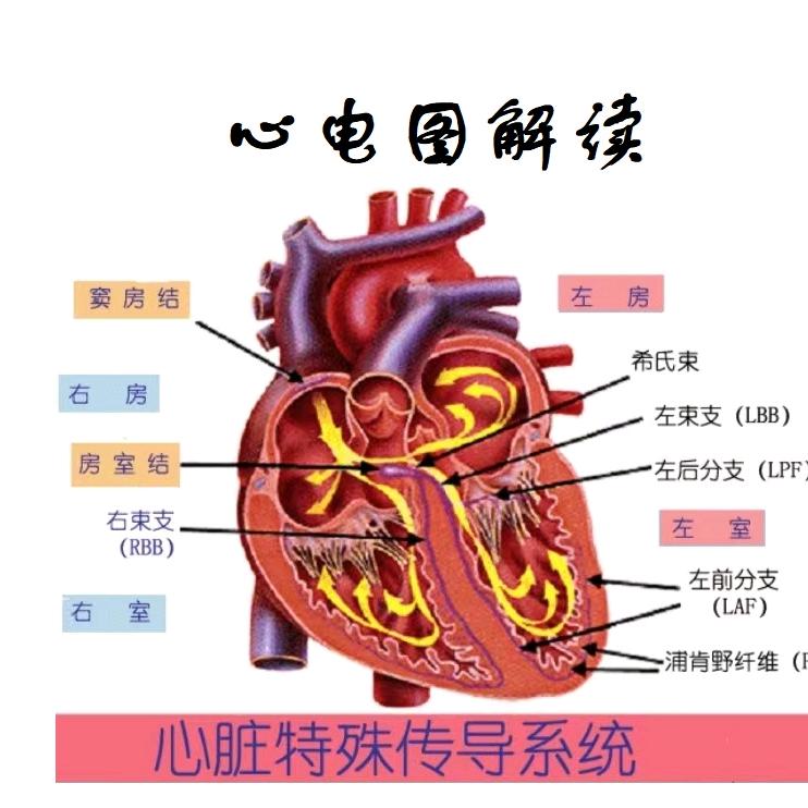 心电图解读