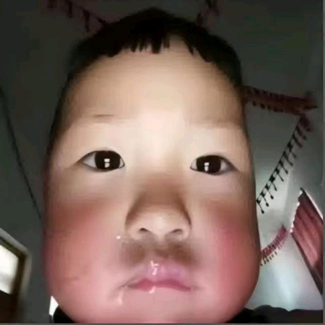 绯世