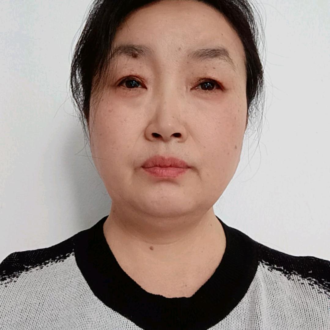 喜姐；@