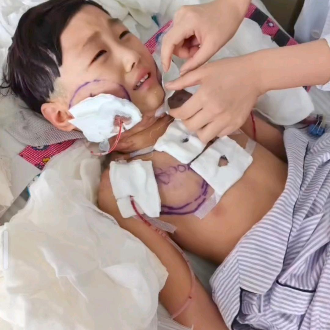 甘肃天水幼儿园烫伤事件(小号)
