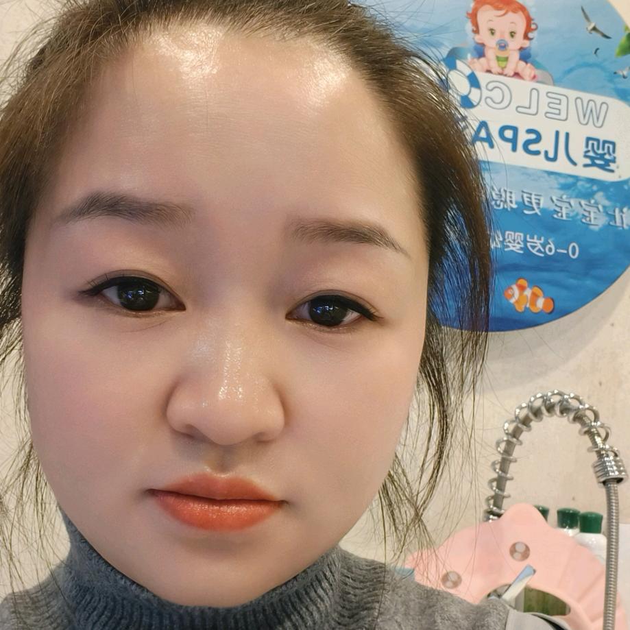 优康宝贝杨琴
