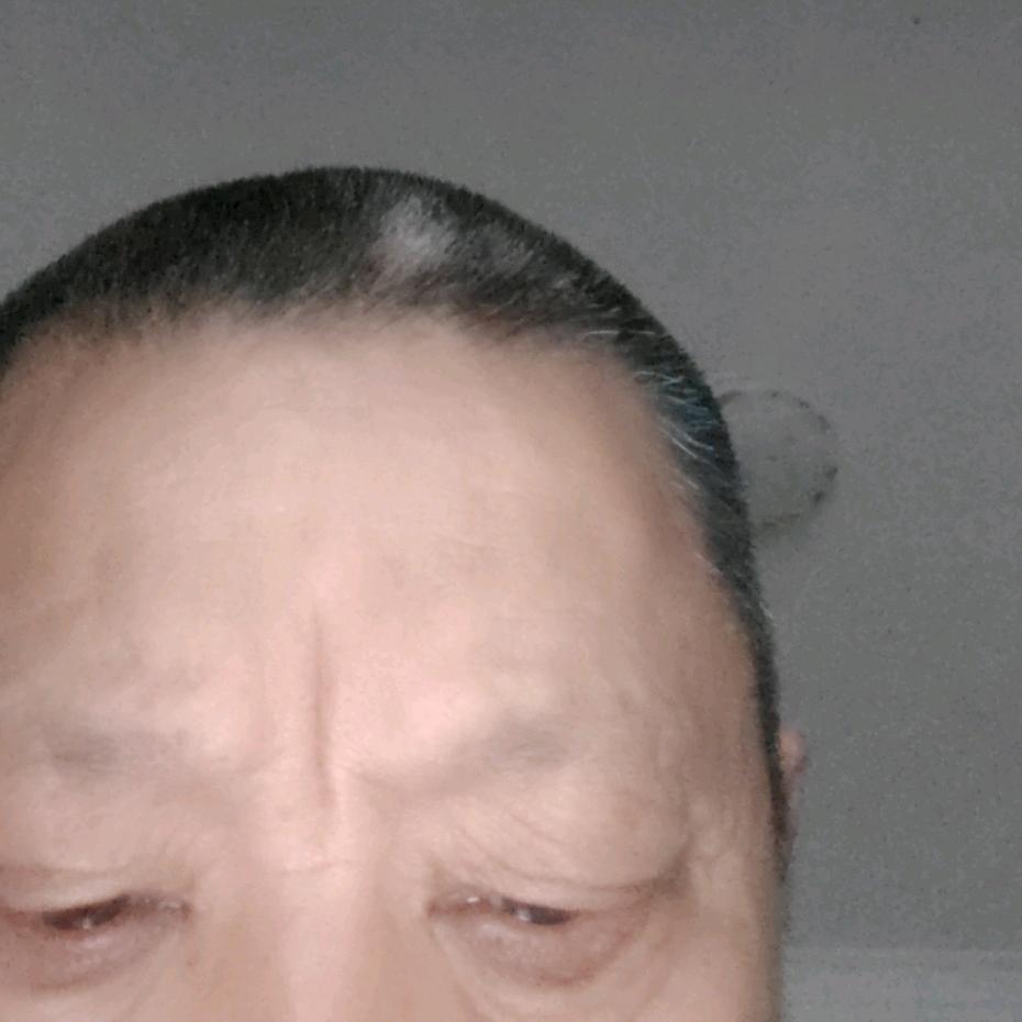 @1Y一r