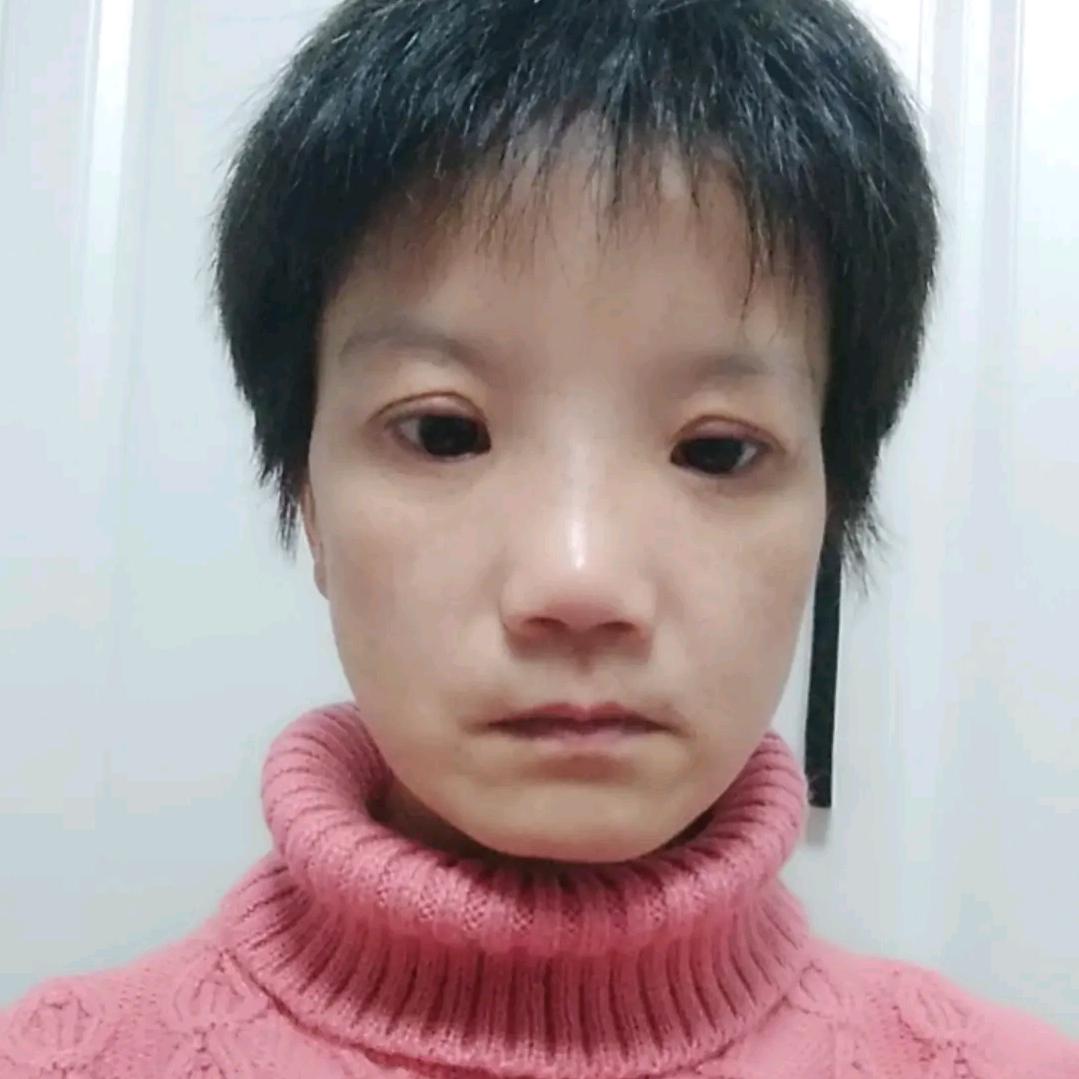 刘婷婷