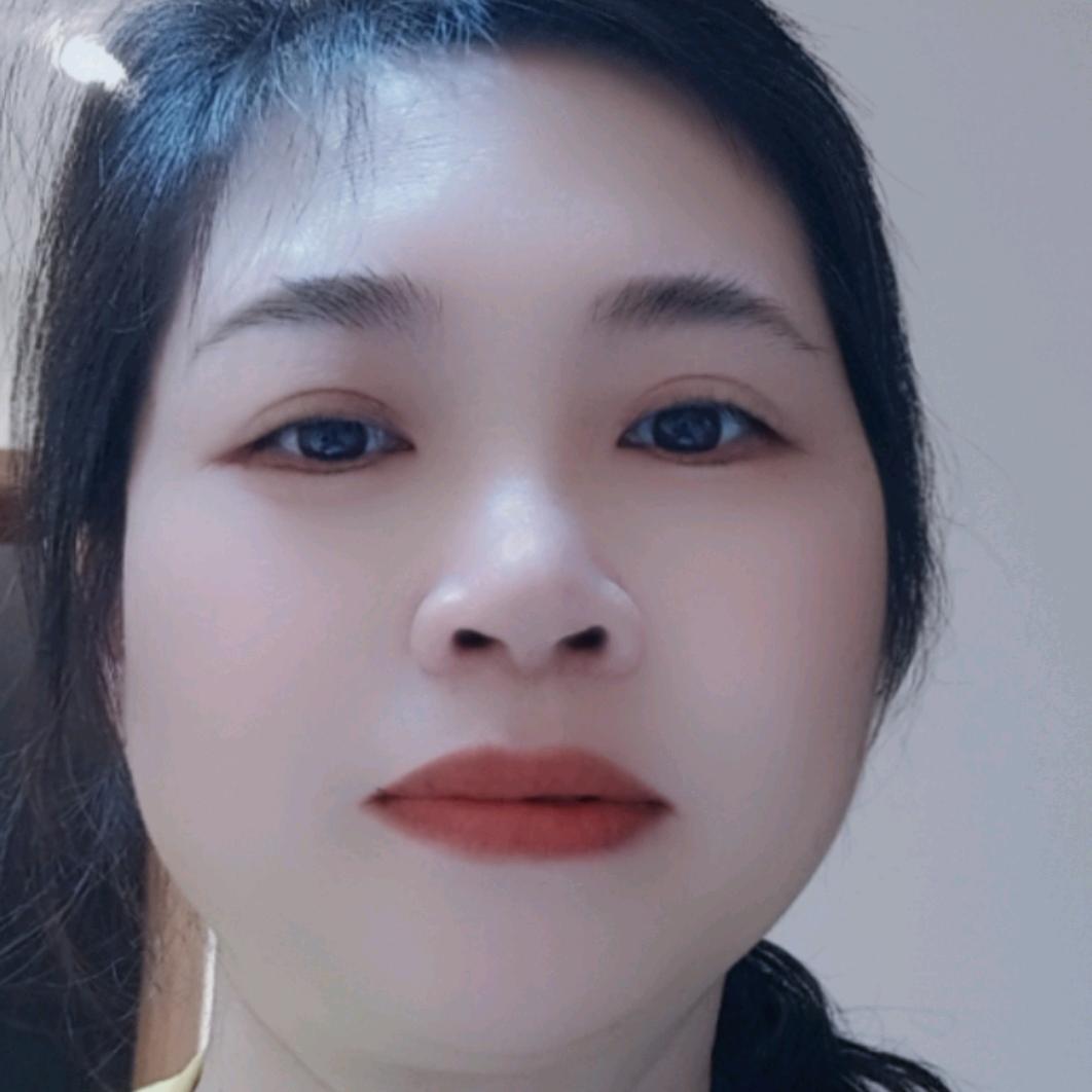 阿兰直播