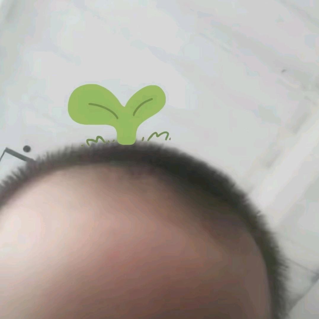 发芽🌱脑袋