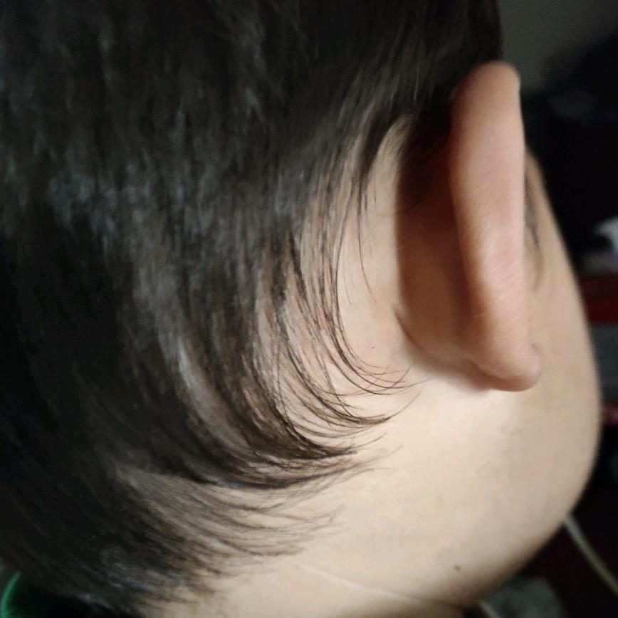 小月