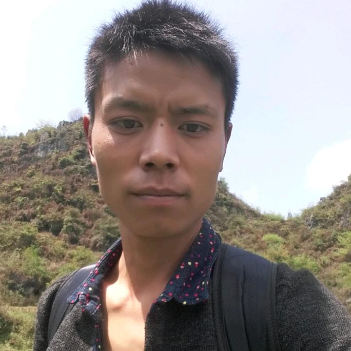 2021年狼疮患者