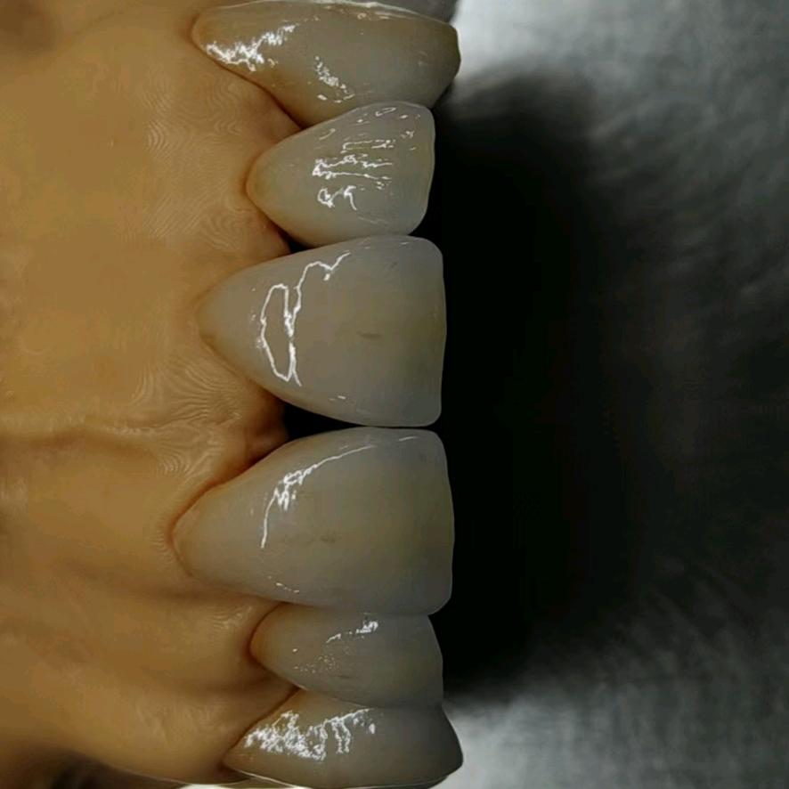 🗿自摸清一色⛲️