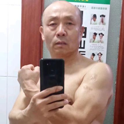 以前有头发