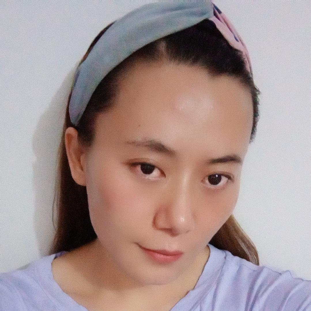 琼琼