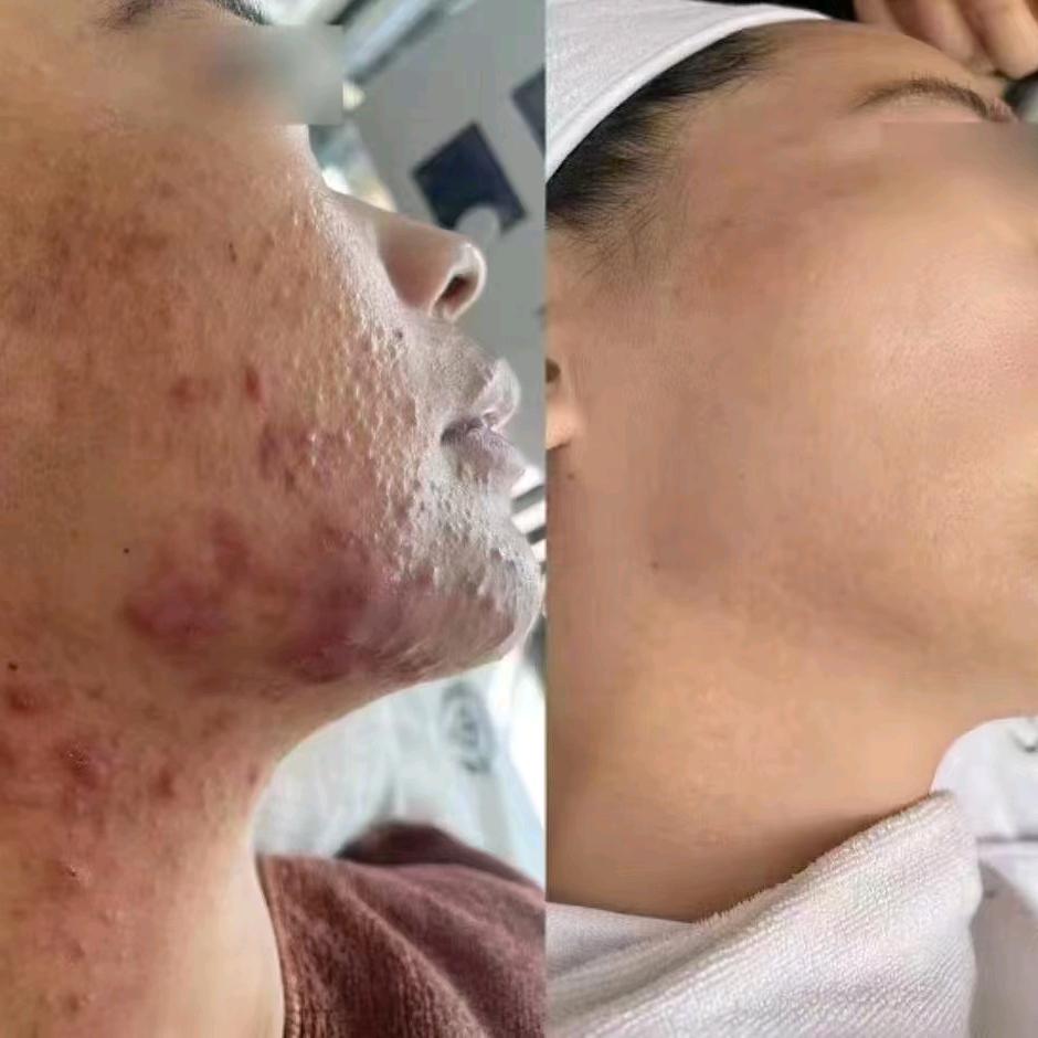 调理斑、痘、敏