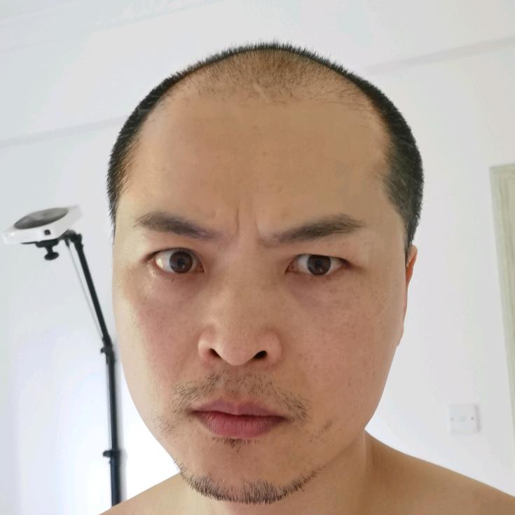 楚哥脱发自救