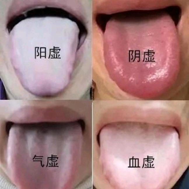 中药调理