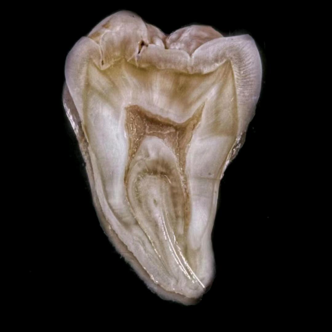 劈哩叭啦~牙牙仙子