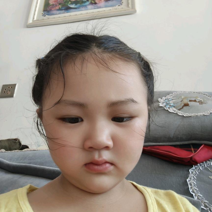 多余