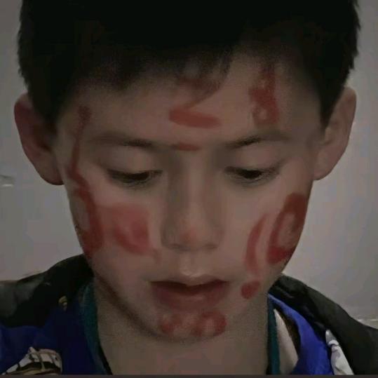 ABA