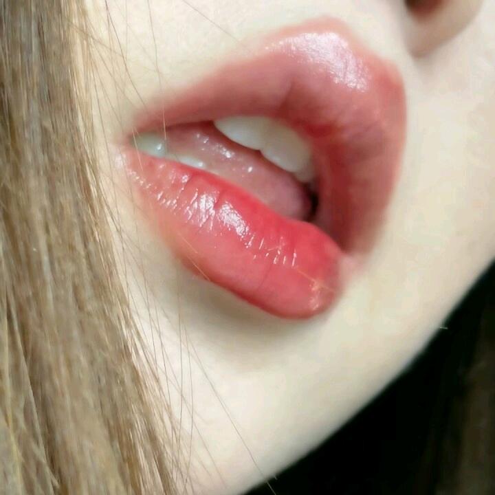 小米松