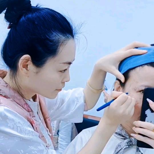 宝鸡 珈兰纳问题肌终点站  小赵
