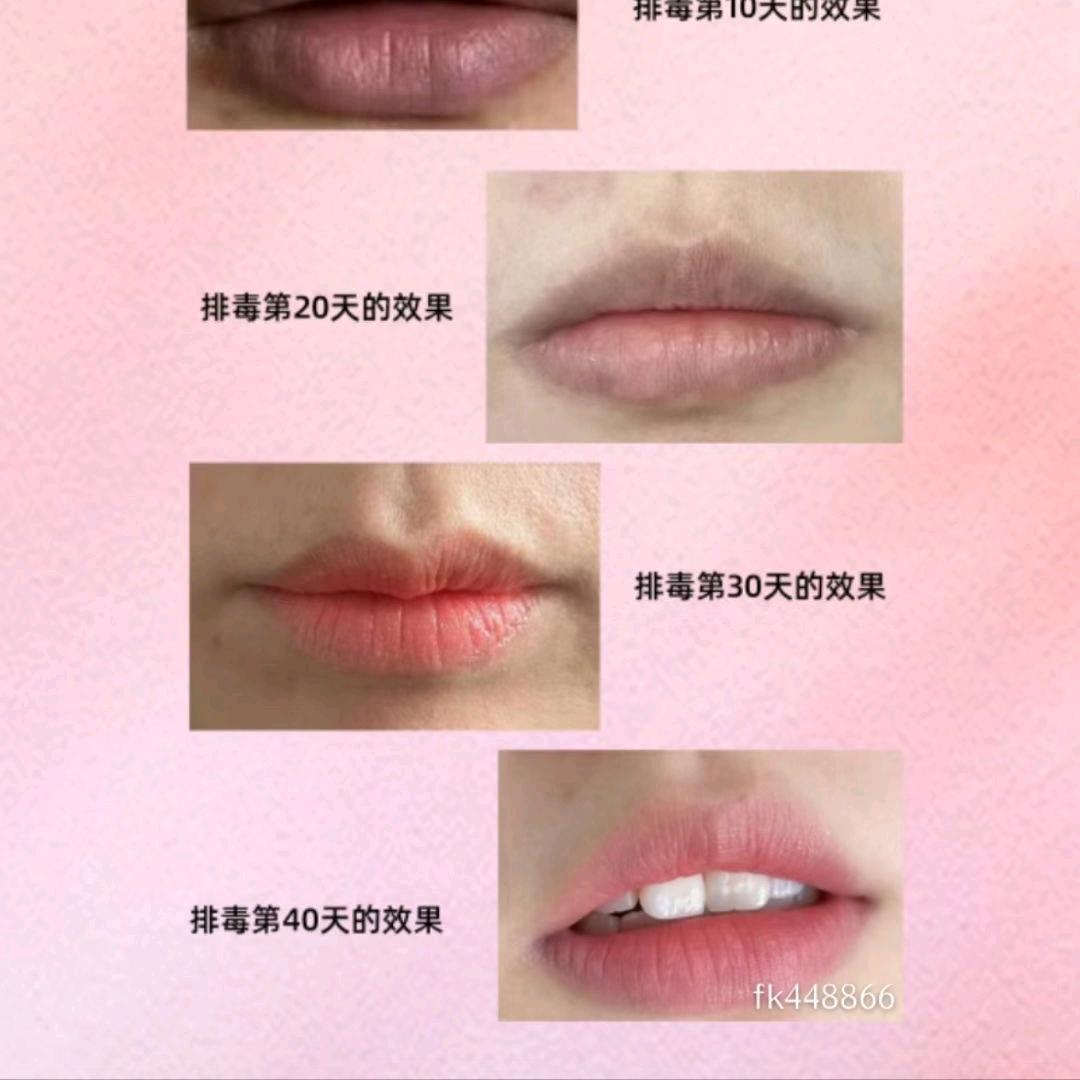 粉蜜世佳粉嫩厦门