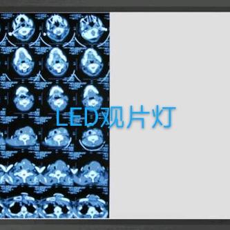 照明哥哥（LED观片灯）