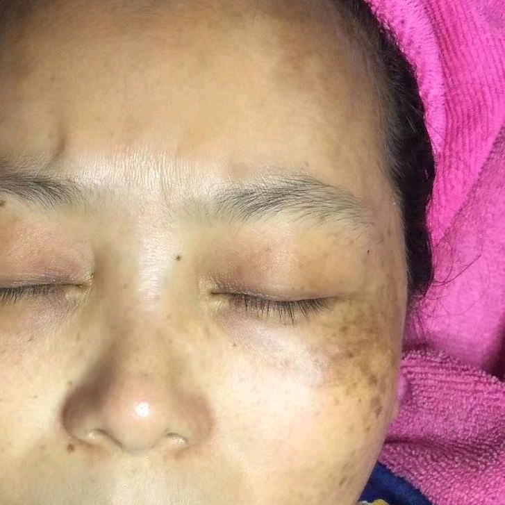 肥西老秦肌肤管理2号