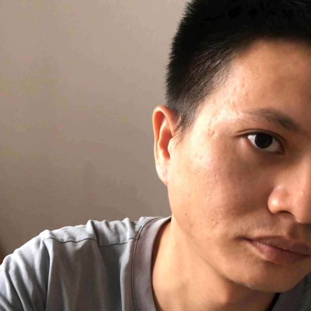 阿轩