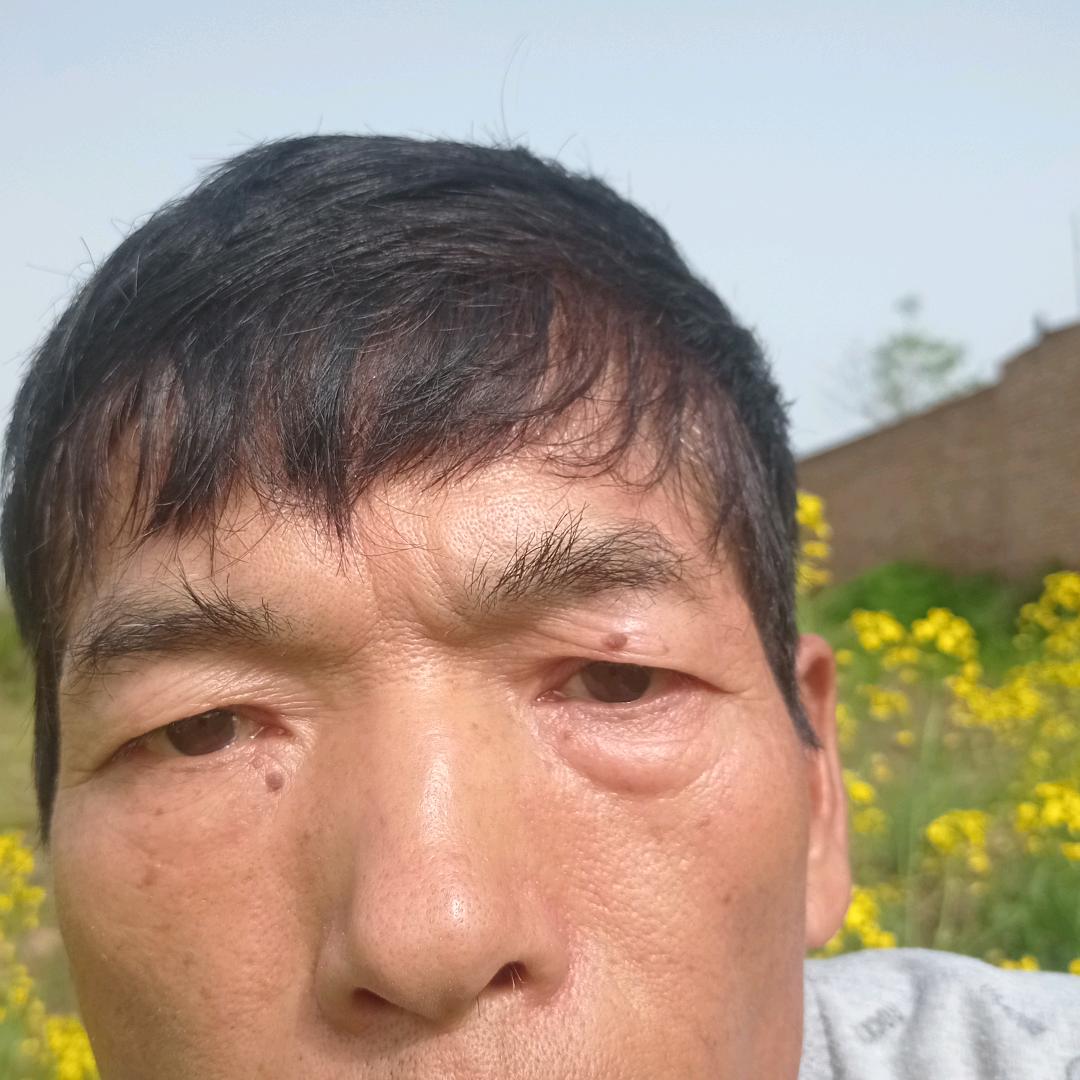 琳琳爱睡觉🌹🌹