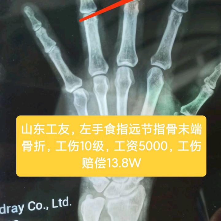 山东工伤咨询