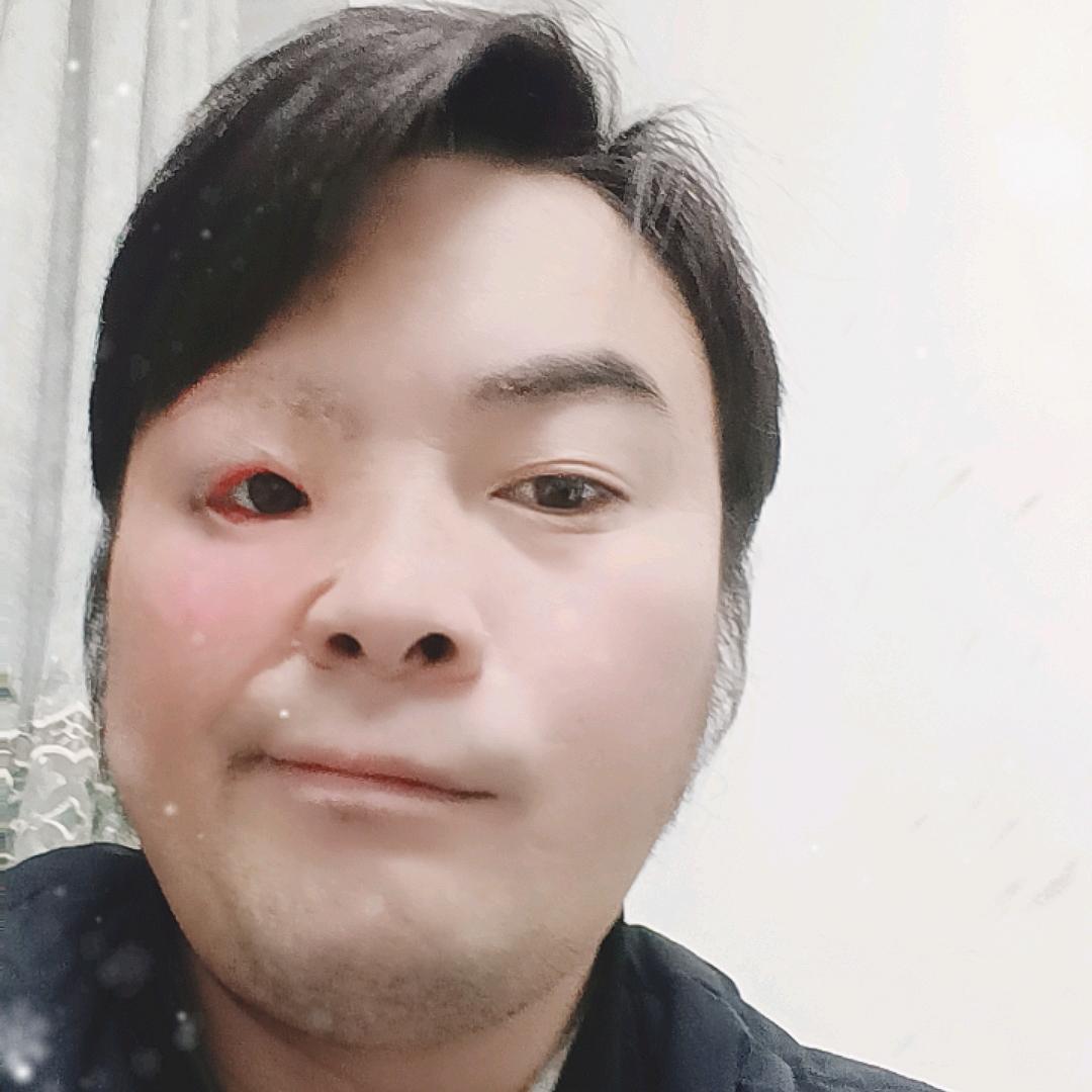 疤哥
