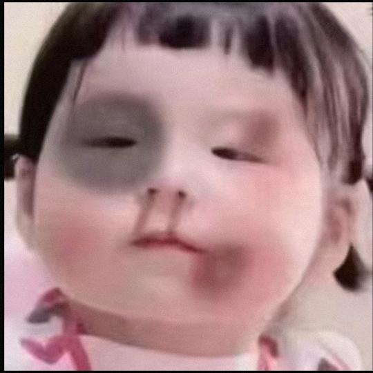 屎没憋住被护工暴打