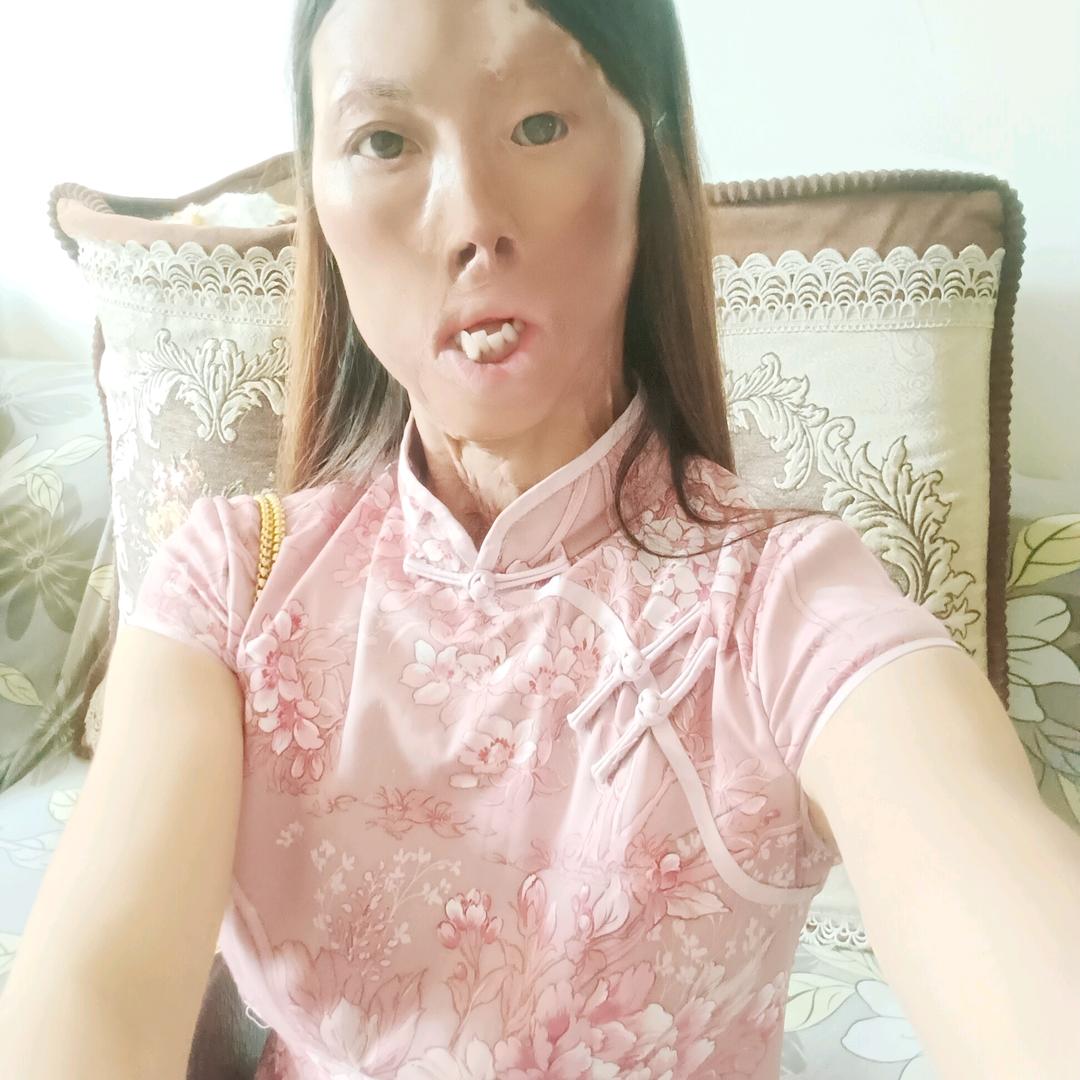 浴火重生，小兰