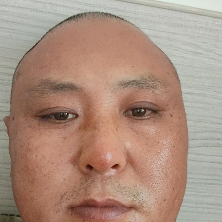 光头哥