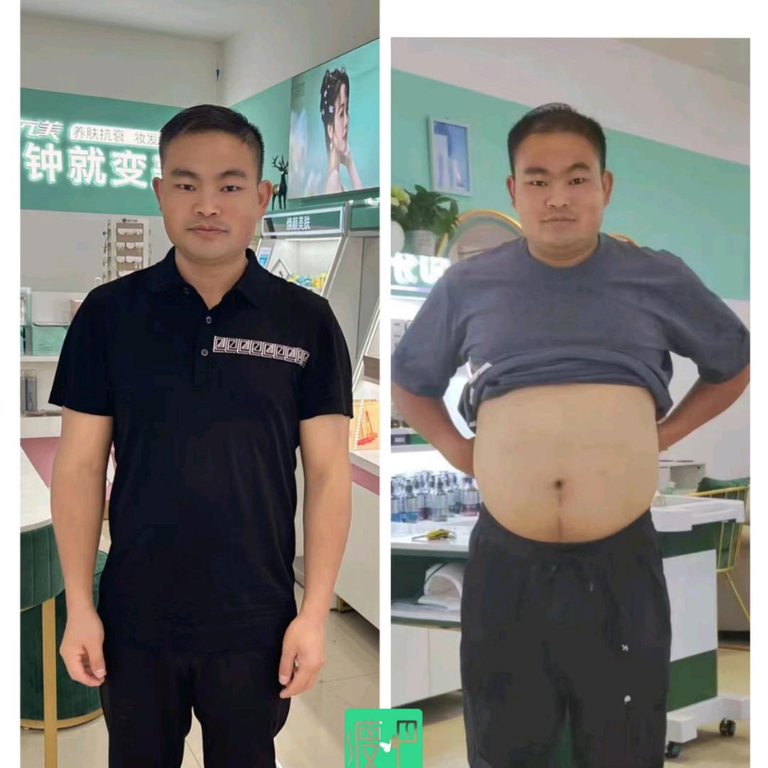 彭强（瘦吧典范）