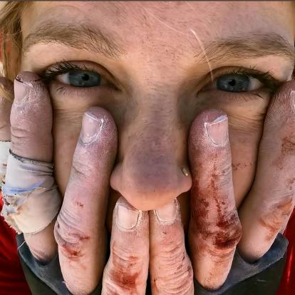 ㅤㅤ ㅤㅤㅤㅤ耍帅被砍18刀.