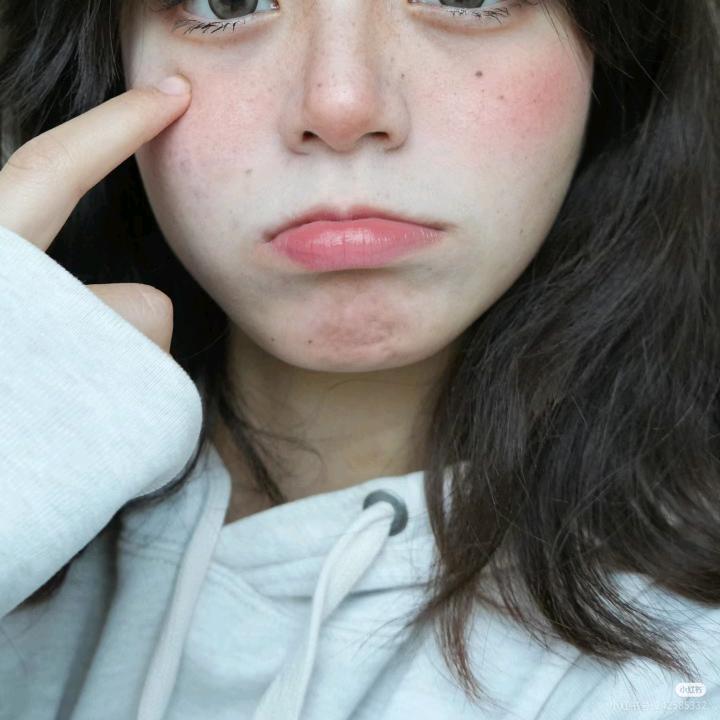 小屁灵