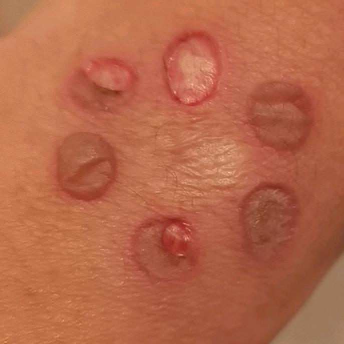 💔💔💔㞮 孞💔💔💔