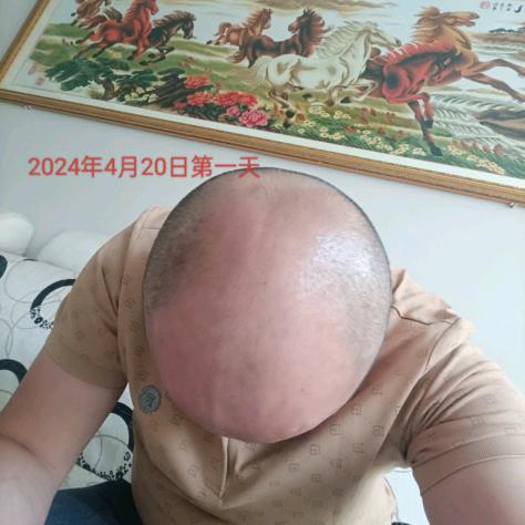 孤军（七级脱发已上岸）