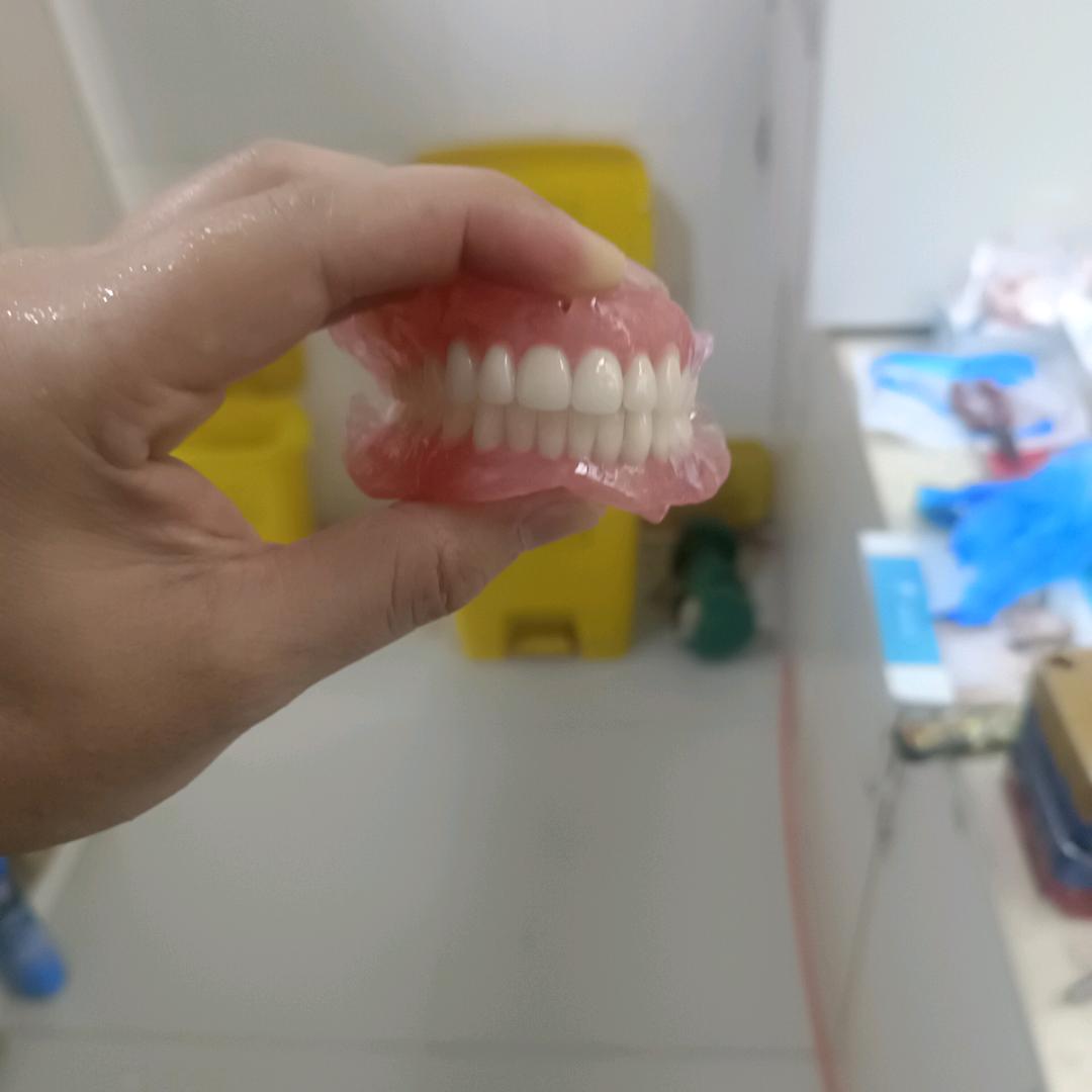 功能性义齿杜永杰