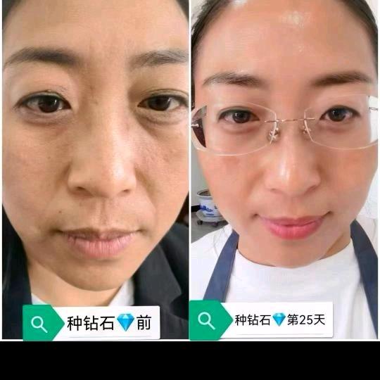 韩国种钻石💎执行总监小七
