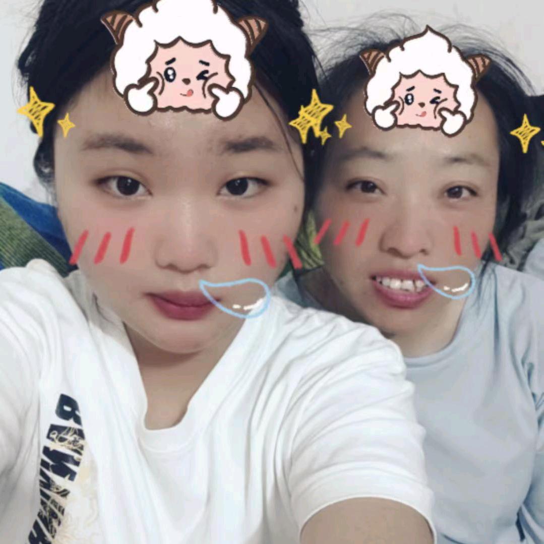 黎静