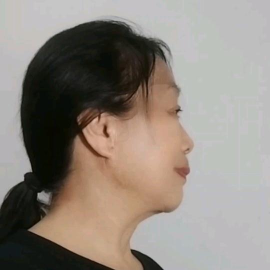阳光A