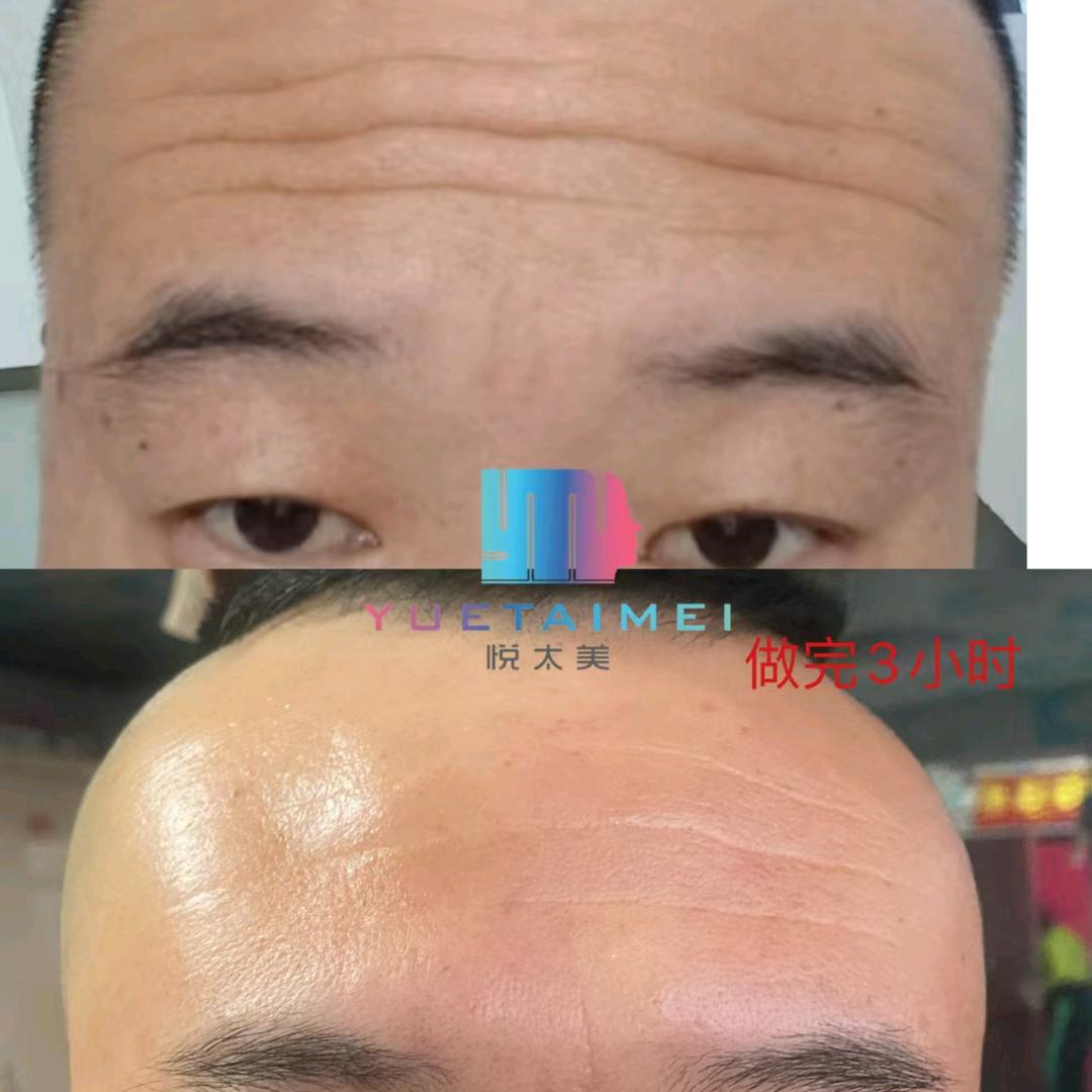 招聘移动美容师