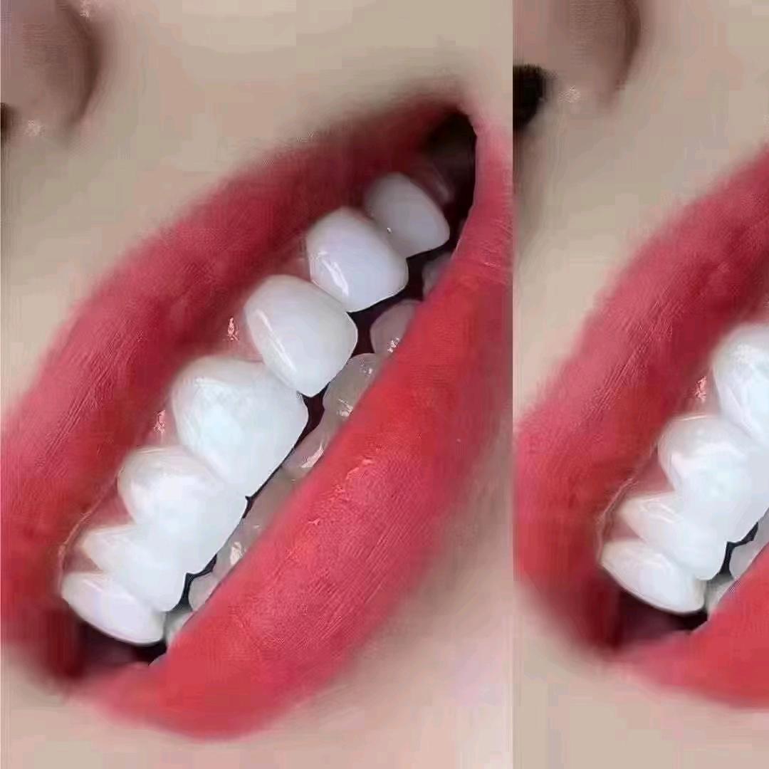 爱康    郑