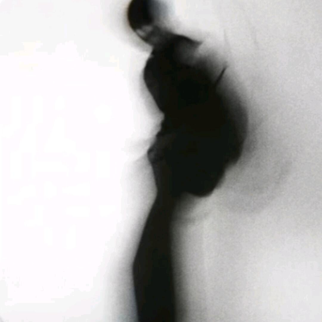 升